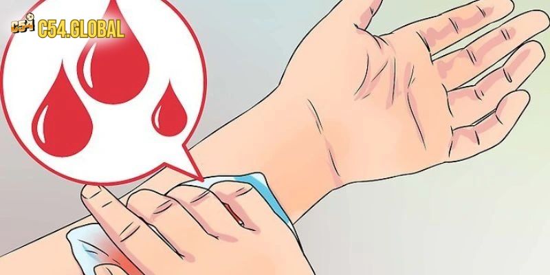 Mơ đứt tay không chảy máu